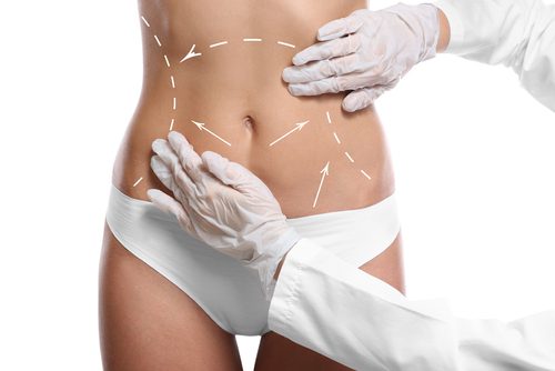 Dr. Charles Messa - What Kind of Body Contouring Is Best for Me?