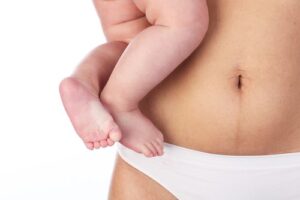Dr. Charles Messa - How Can a Body Lift Help After Pregnancy?