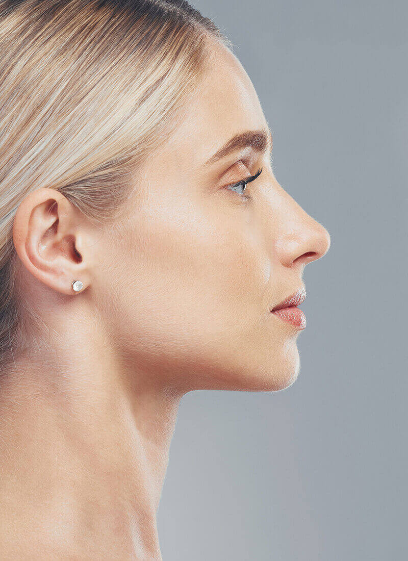 side profile view of a woman with a firm balanced nose